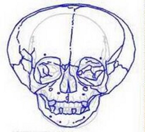 {#alien connelly skull2.jpg}